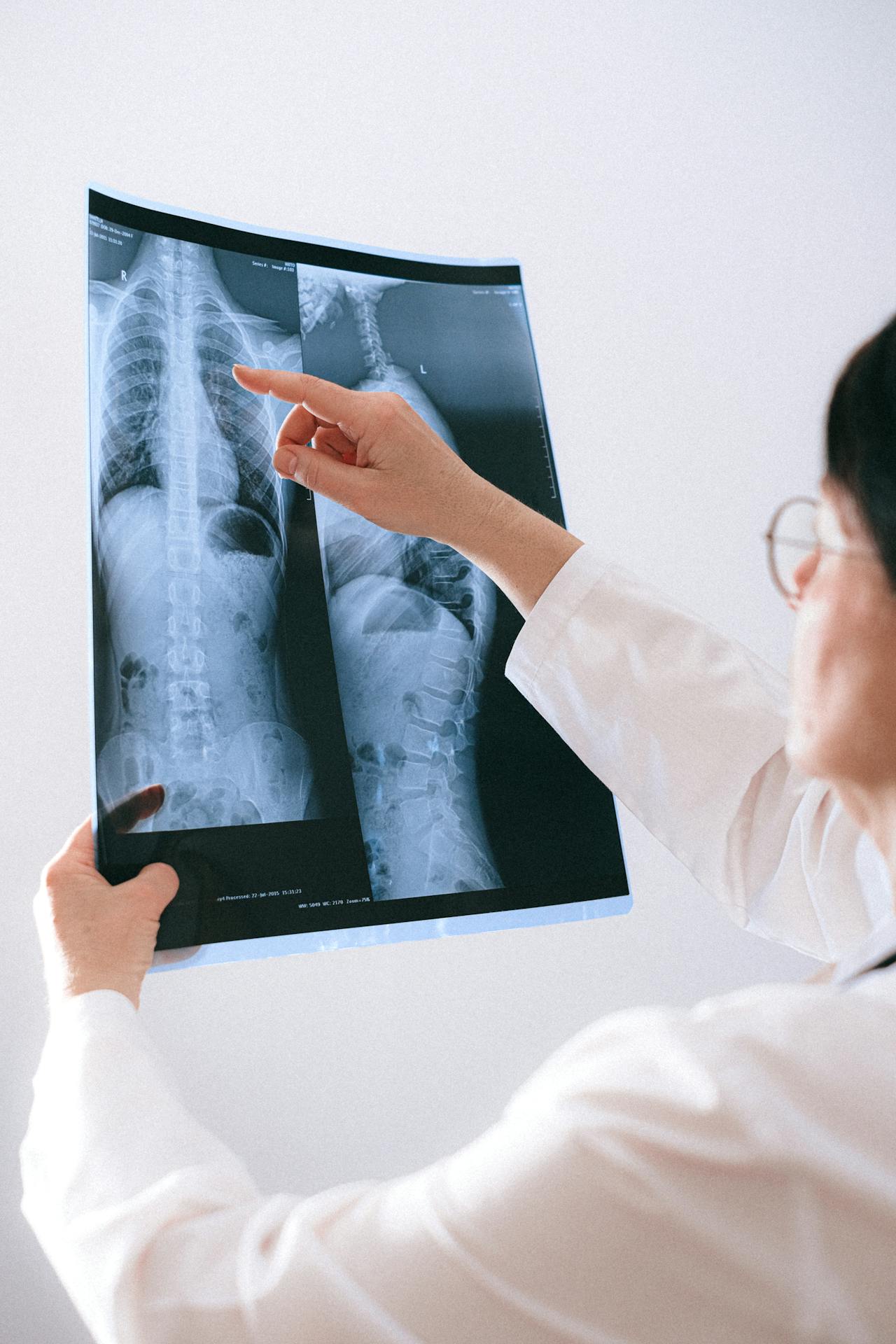 X-Ray