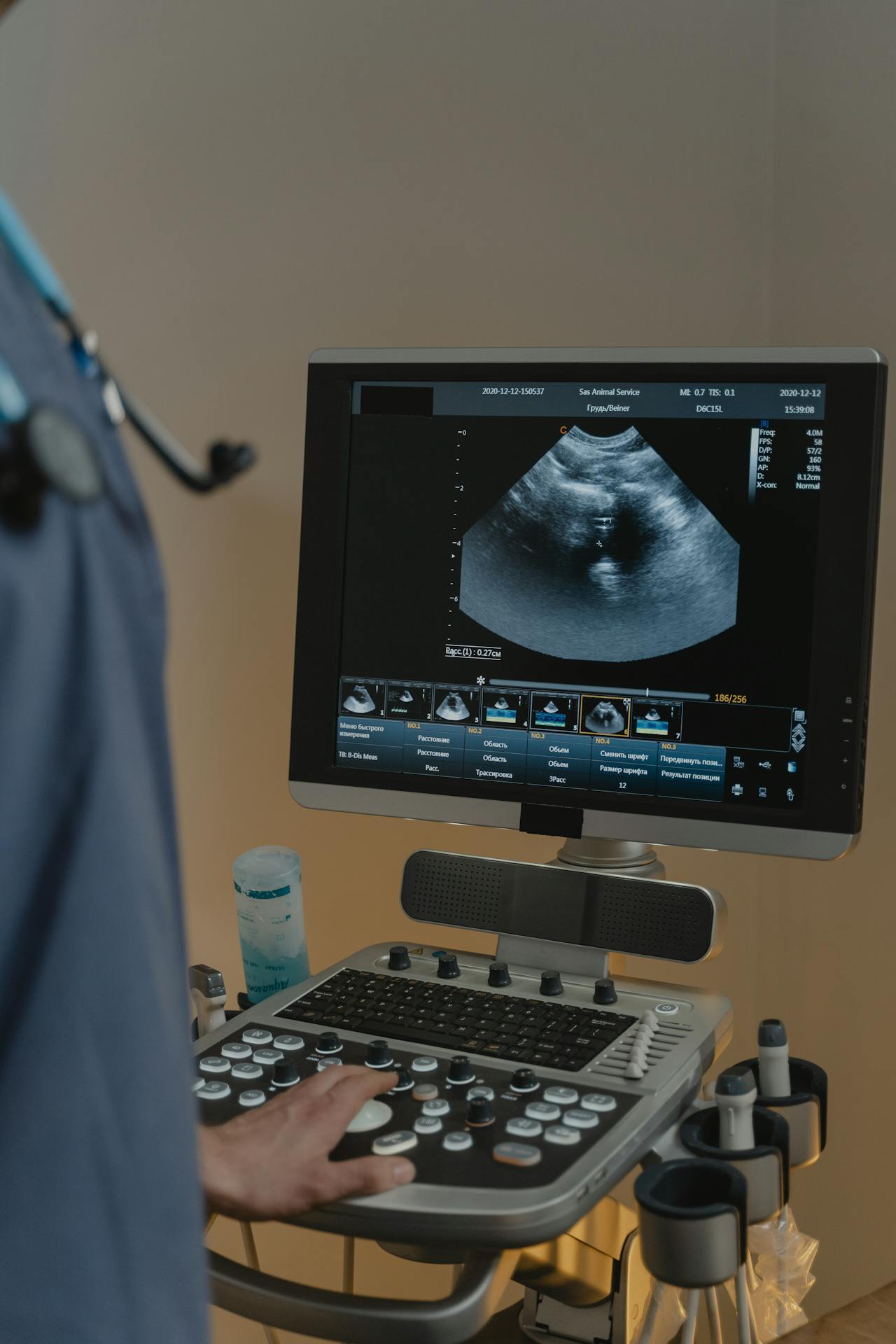 Sonography Test